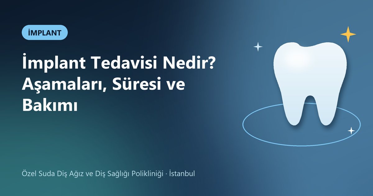 İmplant Tedavisi Nedir? Aşamaları, Süresi ve Bakımı – Suda Diş blog kapak görseli